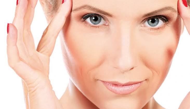 Harmonização facial