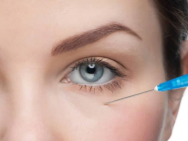 Preenchimento de olheiras