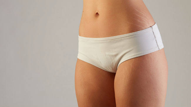 Tratamento para estrias