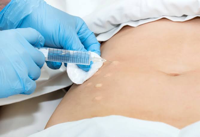 Tratamento para flacidez